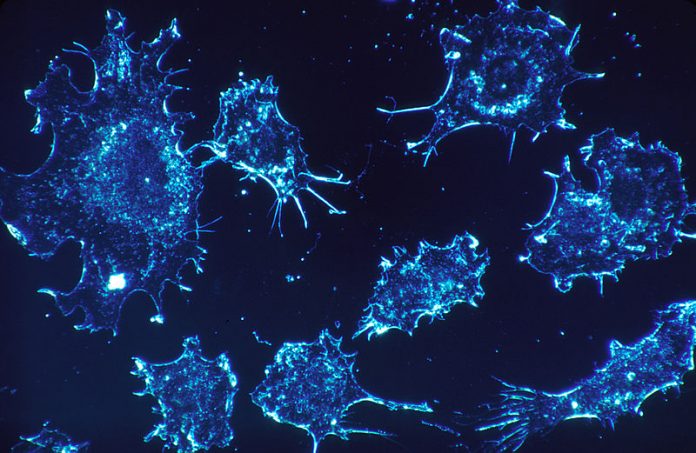Cancer Gets the Artificial Intelligence Treatment