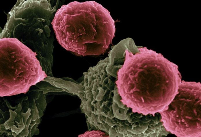 AI Image Processing Can Aid in Predicting Immunotherapy Efficacy