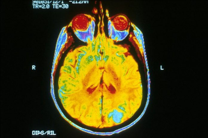 Nvidia Uses Neural Networks to Produce Synthetic Scans of Brain Cancer