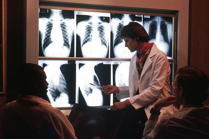 Deep Learning Algorithm as Accurate as Radiologists in Identifying Breast Density