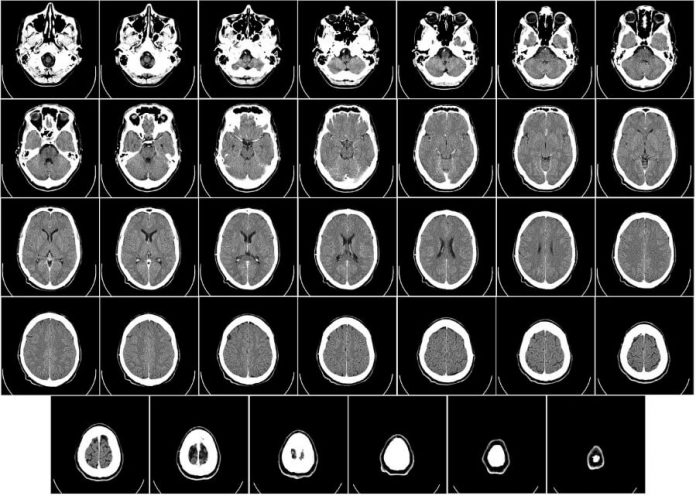 Deep Learning AI Imaging to Accelerate Patient Diagnoses (1)